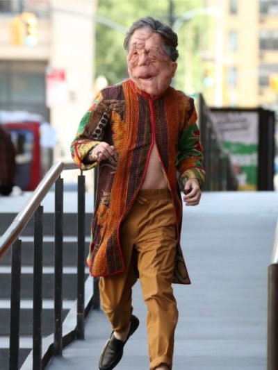 A Different Man 2024 Adam Pearson Coat